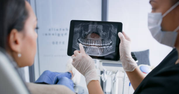 Licensed Tooth Extraction service in La Verne, CA - Smile Center Dentistry